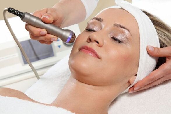 Biorevitalización con láser
